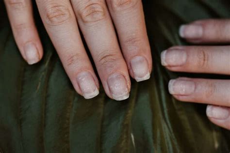 are fake nails dangerous